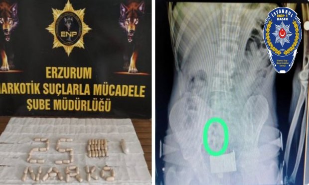 Erzurum’da kuryelerin midelerinden 558 gram uyuşturucu çıktı...