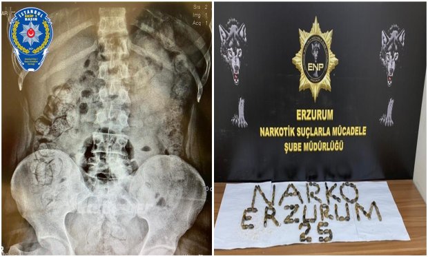 Erzurum’da 6 kilo 145 gram afyon sakızı ele geçirildi...